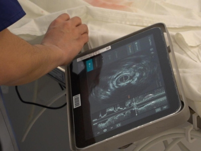 Егорьевский сосудистый центр освоил передовую методику внутрисосудистого УЗИ сердца  