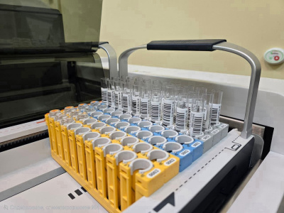 В Коломенской больнице можно пройти тестирование на ВИЧ